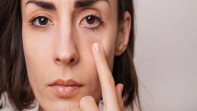 5 pola hidup sehat untuk pengidap glaukoma